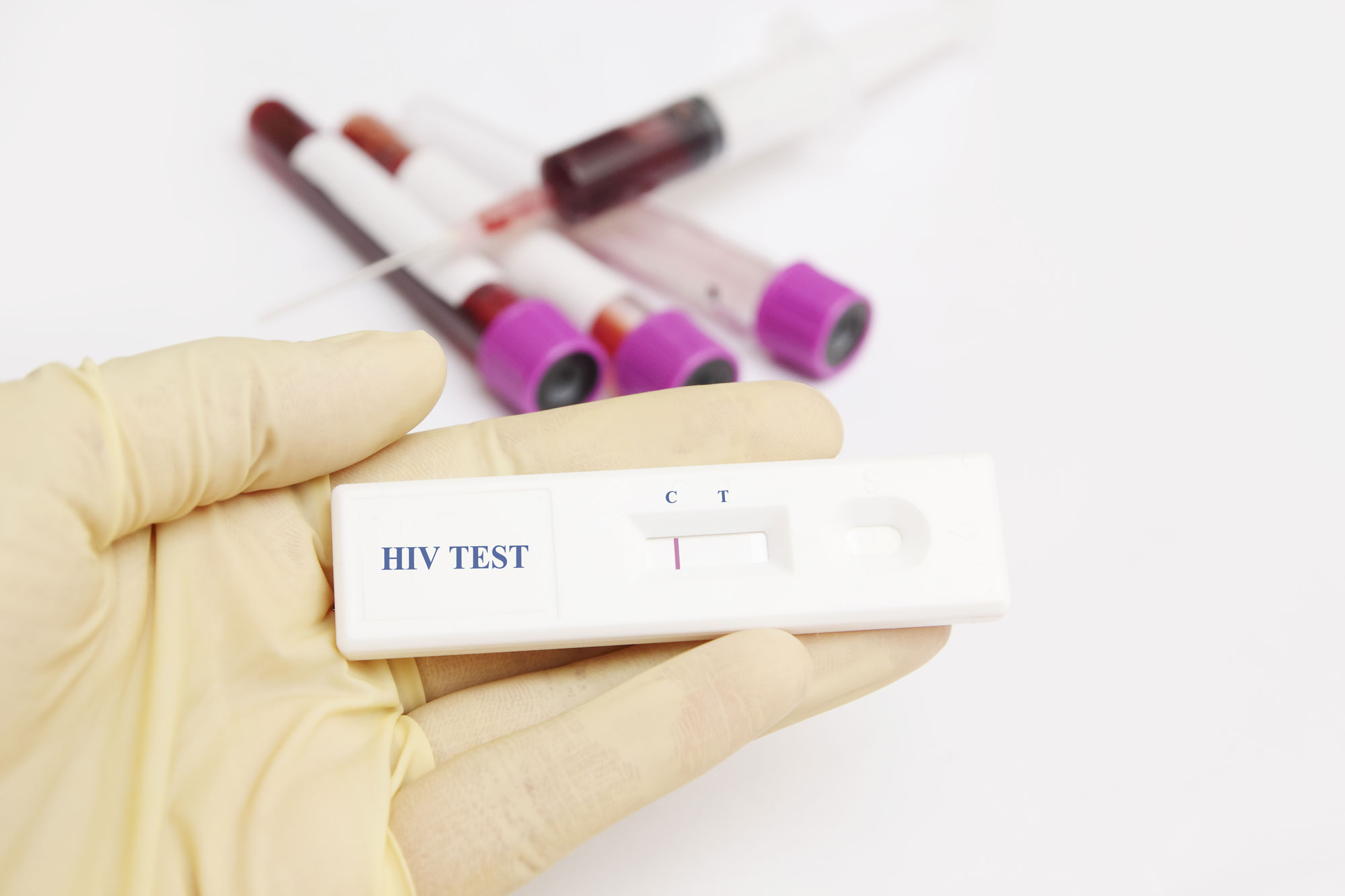Test HIV Lietuva lt